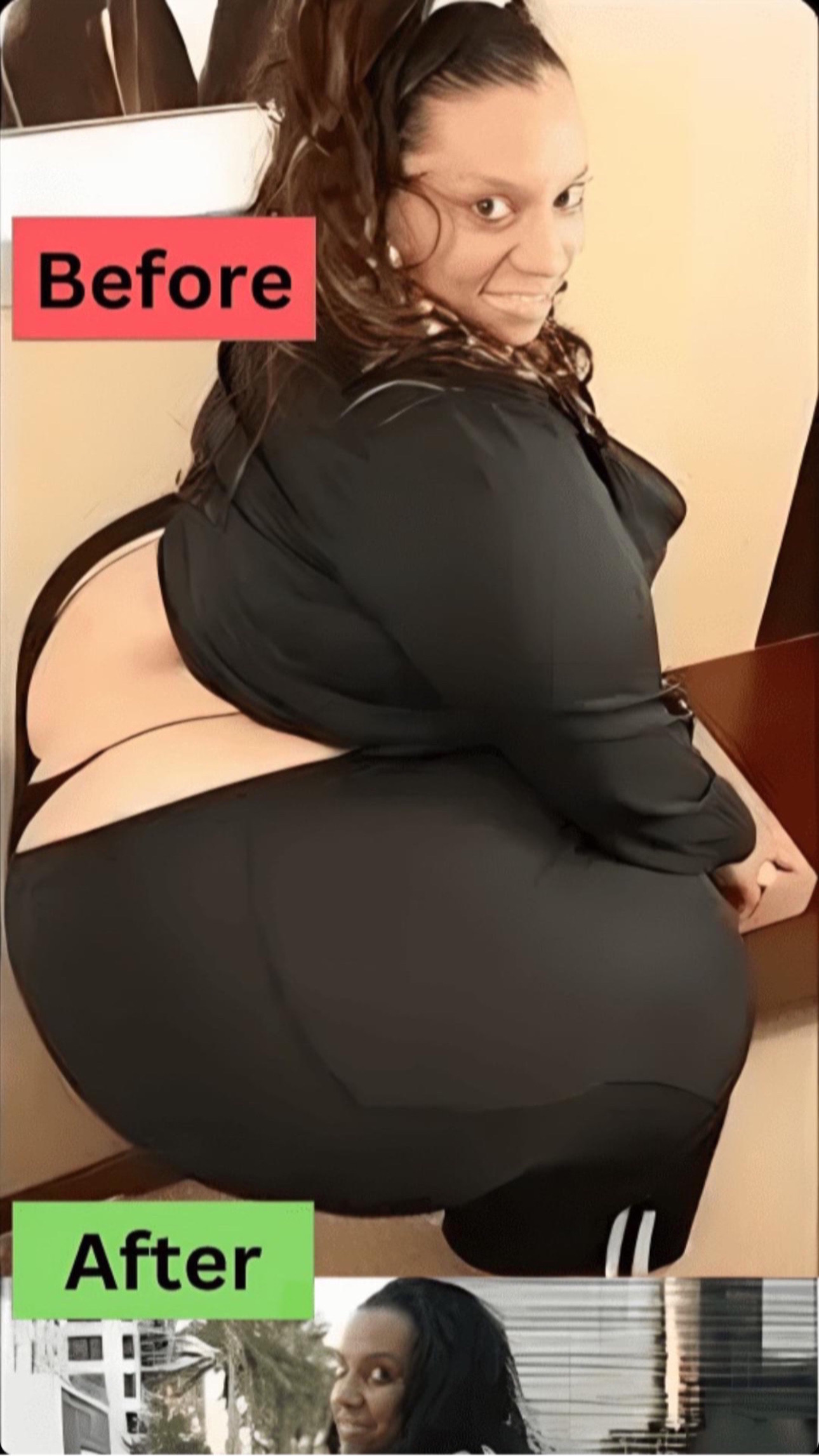 World’s largest hips