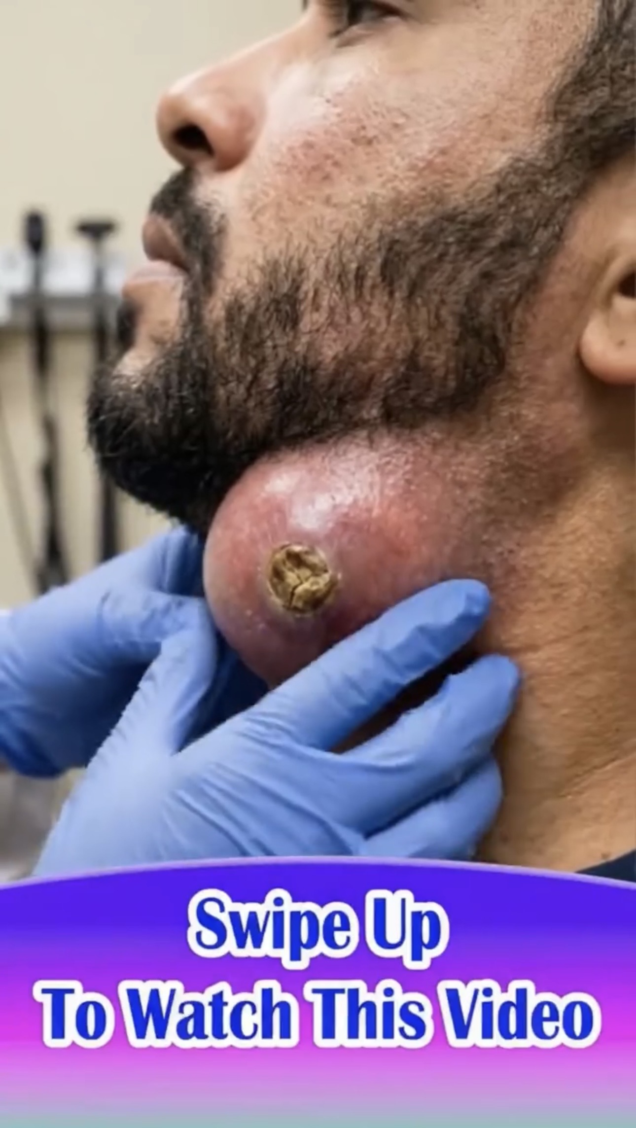 A Large Lump Under the Chin Leaves Viewers Curious